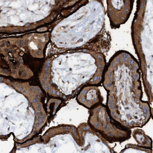 Immunohistochemistry (Formalin/PFA-fixed paraffin-embedded sections) - Anti-SLC16A3/MCT 4 antibody (AB244385)
