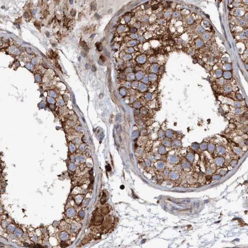 Immunohistochemistry (Formalin/PFA-fixed paraffin-embedded sections) - Anti-SLC16A3/MCT 4 antibody (AB244385)