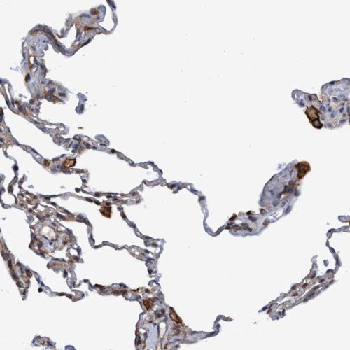 Immunohistochemistry (Formalin/PFA-fixed paraffin-embedded sections) - Anti-SLC16A3/MCT 4 antibody (AB244385)