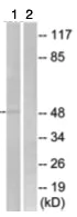 Western blot - Anti-SLC16A3/MCT 4 antibody (AB74109)