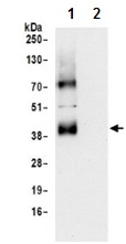 Immunoprecipitation - Anti-SLC16A3/MCT 4 antibody - C-terminal (AB190497), expandable thumbnail