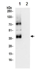 Immunoprecipitation - Anti-SLC16A3/MCT 4 antibody - C-terminal (AB190497)