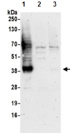 Western blot - Anti-SLC16A3/MCT 4 antibody - C-terminal (AB190497), expandable thumbnail