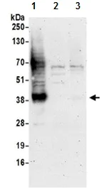 Western blot - Anti-SLC16A3/MCT 4 antibody - C-terminal (AB190497)