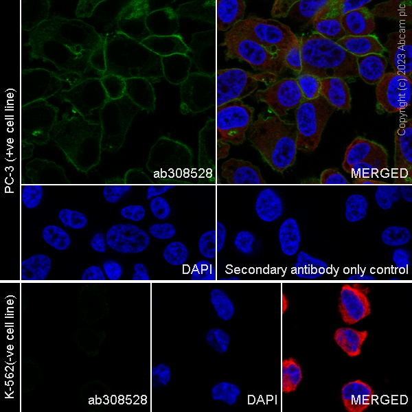 Immunocytochemistry/ Immunofluorescence - Anti-SLC16A3/MCT 4 antibody [EPR28177-30] (ab308528), expandable thumbnail