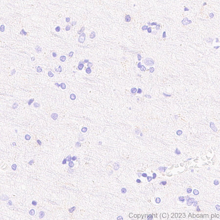 Immunohistochemistry (Formalin/PFA-fixed paraffin-embedded sections) - Anti-SLC16A3/MCT 4 antibody [EPR28177-30] (ab308528), expandable thumbnail