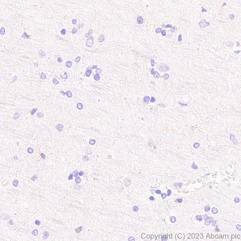 Immunohistochemistry (Formalin/PFA-fixed paraffin-embedded sections) - Anti-SLC16A3/MCT 4 antibody [EPR28177-30] (AB308528)