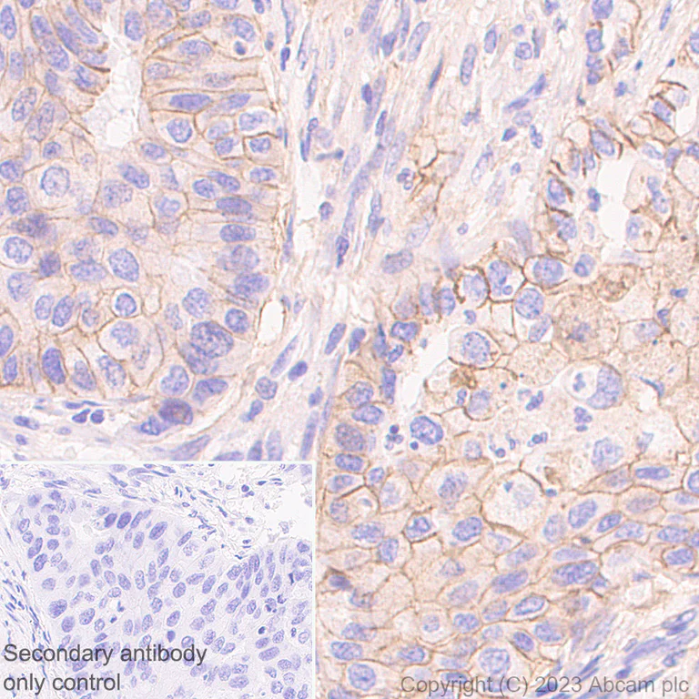 Immunohistochemistry (Formalin/PFA-fixed paraffin-embedded sections) - Anti-SLC16A3/MCT 4 antibody [EPR28177-30] (AB308528)