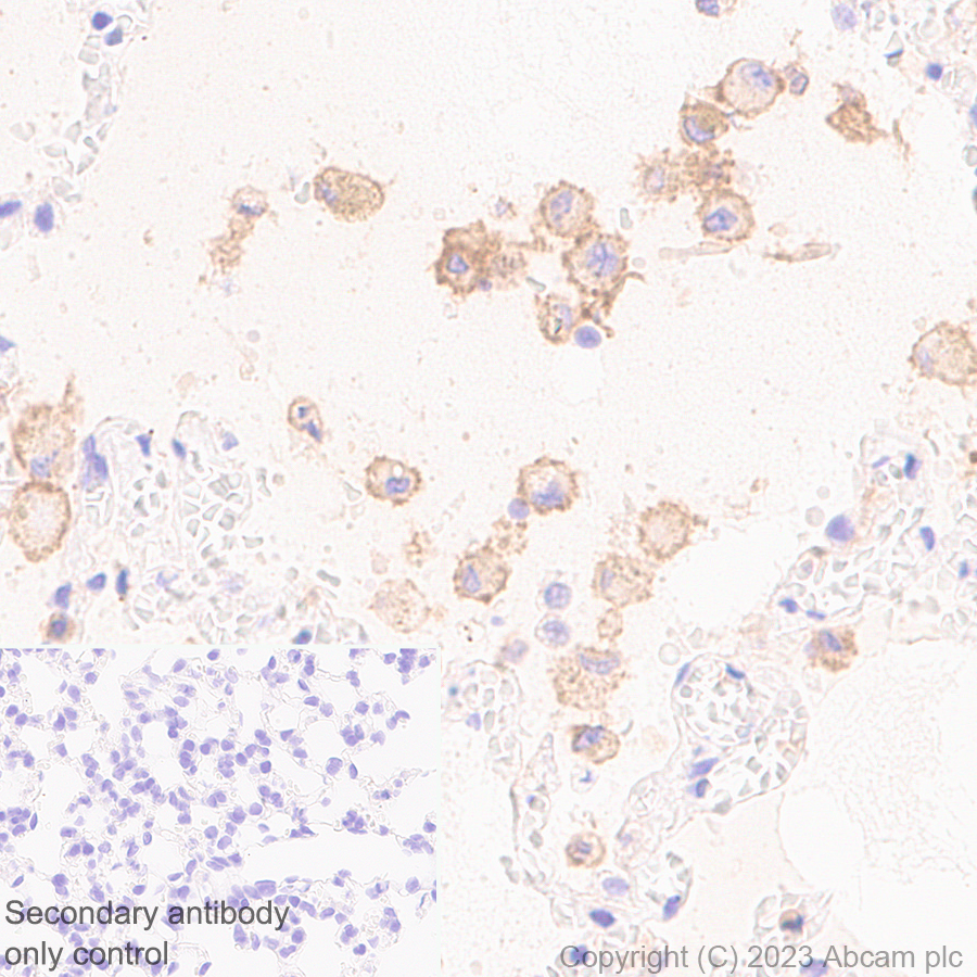 Immunohistochemistry (Formalin/PFA-fixed paraffin-embedded sections) - Anti-SLC16A3/MCT 4 antibody [EPR28177-30] (AB308528), expandable thumbnail