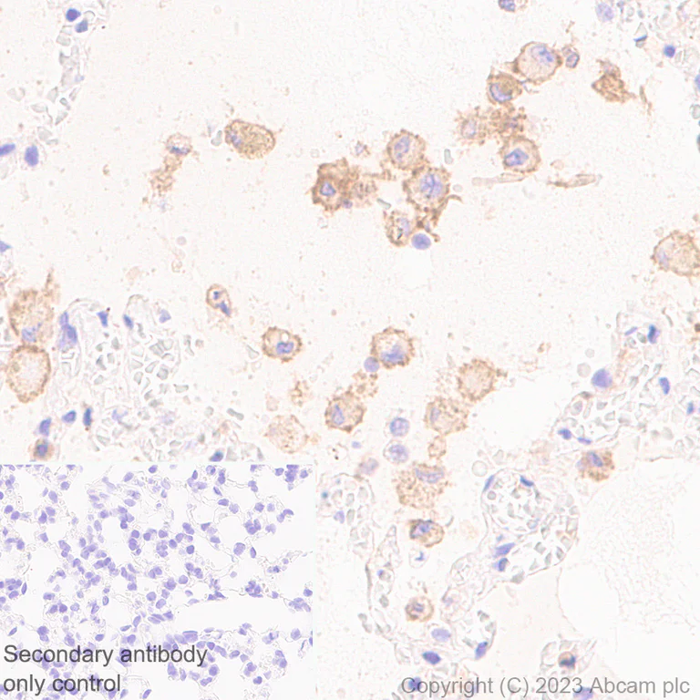 Immunohistochemistry (Formalin/PFA-fixed paraffin-embedded sections) - Anti-SLC16A3/MCT 4 antibody [EPR28177-30] (AB308528)