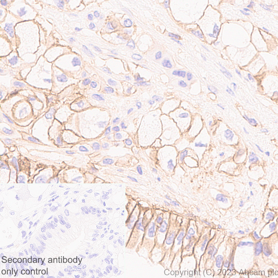 Immunohistochemistry (Formalin/PFA-fixed paraffin-embedded sections) - Anti-SLC16A3/MCT 4 antibody [EPR28177-30] (AB308528), expandable thumbnail