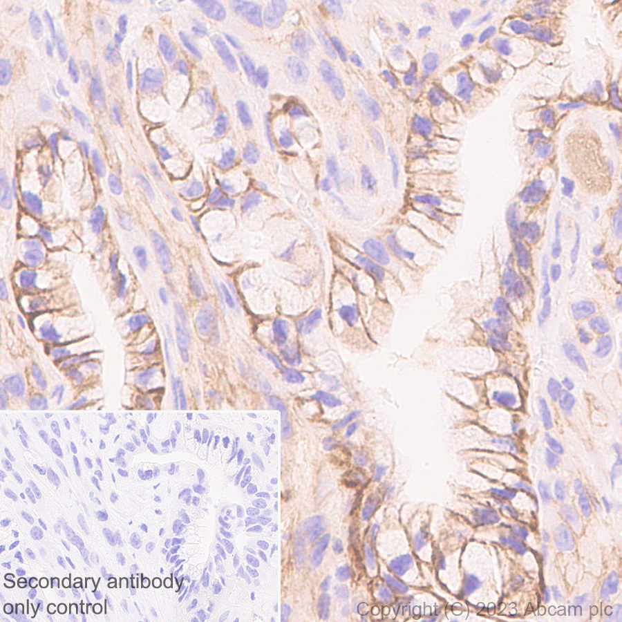 Immunohistochemistry (Formalin/PFA-fixed paraffin-embedded sections) - Anti-SLC16A3/MCT 4 antibody [EPR28177-30] (AB308528), expandable thumbnail