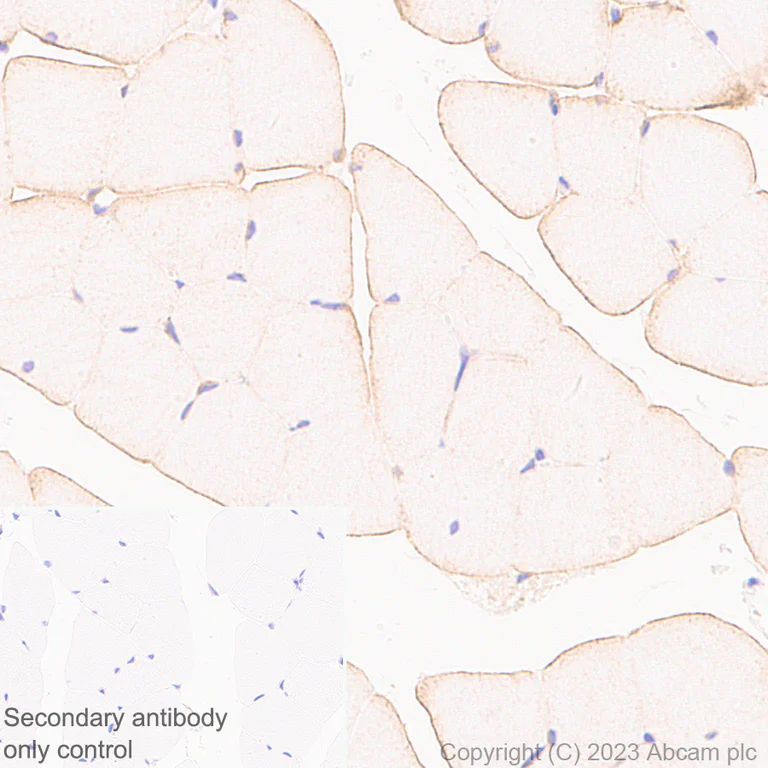 Immunohistochemistry (Formalin/PFA-fixed paraffin-embedded sections) - Anti-SLC16A3/MCT 4 antibody [EPR28177-30] (AB308528)