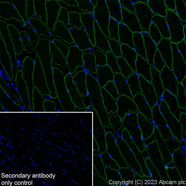 Immunohistochemistry (Frozen sections) - Anti-SLC16A3/MCT 4 antibody [EPR28177-30] (AB308528)