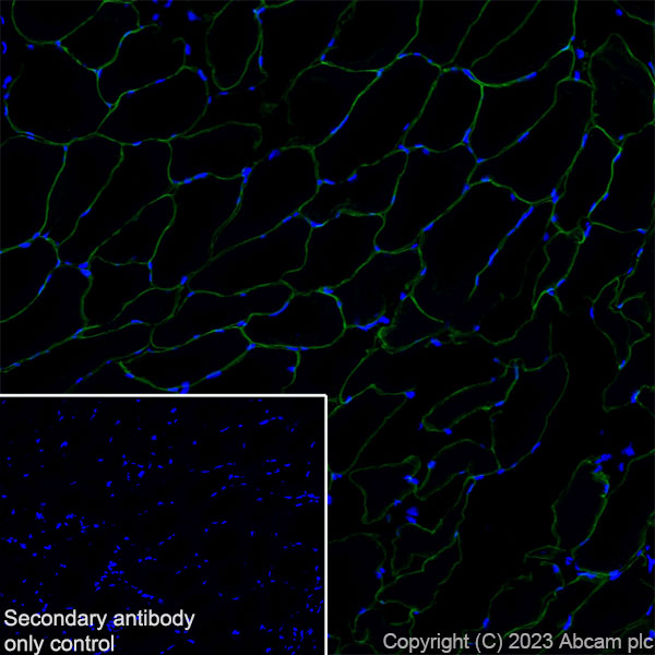 Immunohistochemistry (Frozen sections) - Anti-SLC16A3/MCT 4 antibody [EPR28177-30] (ab308528), expandable thumbnail