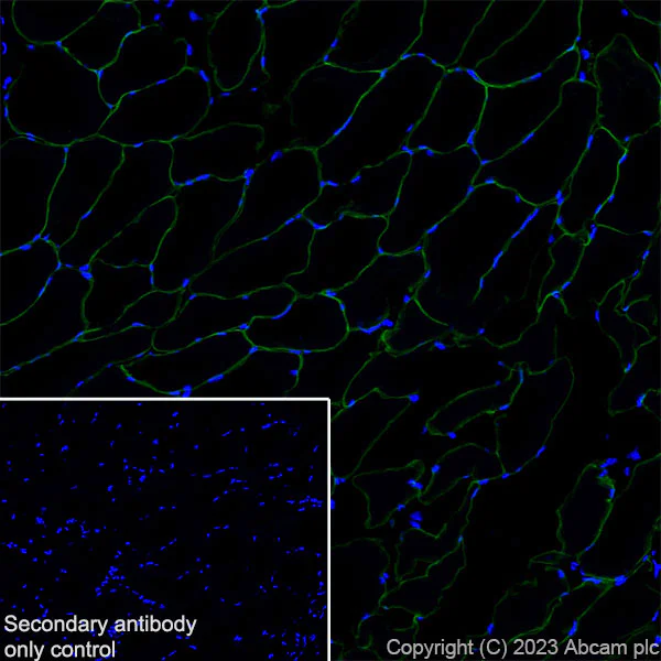 Immunohistochemistry (Frozen sections) - Anti-SLC16A3/MCT 4 antibody [EPR28177-30] (AB308528)