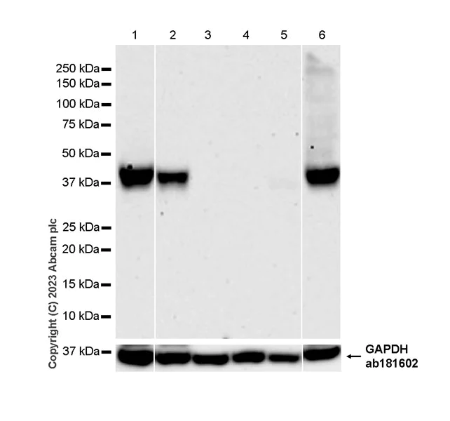 Western blot - Anti-SLC16A3/MCT 4 antibody [EPR28177-30] (AB308528)
