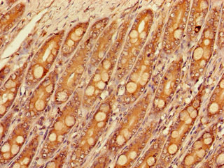 Immunohistochemistry (Formalin/PFA-fixed paraffin-embedded sections) - Anti-SLC16A9 antibody (AB223057), expandable thumbnail