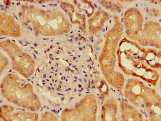 Immunohistochemistry (Formalin/PFA-fixed paraffin-embedded sections) - Anti-SLC16A9 antibody (AB223057), expandable thumbnail