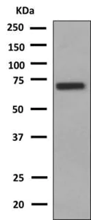 Western blot - Anti-SLC17A1 antibody [EPR9614] (AB151751)