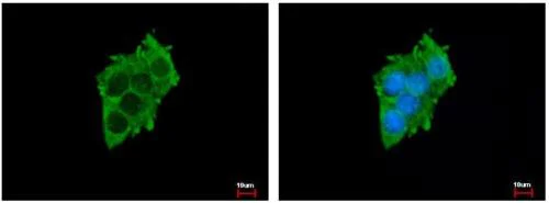 Immunocytochemistry/ Immunofluorescence - Anti-SLC17A5 antibody (AB153920)