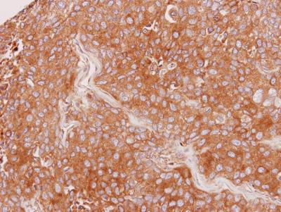 Immunohistochemistry (Formalin/PFA-fixed paraffin-embedded sections) - Anti-SLC17A5 antibody (AB153920)