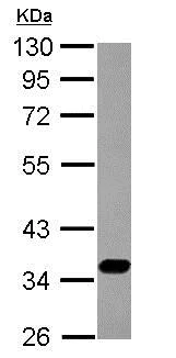 Western blot - Anti-SLC17A5 antibody (AB153920)