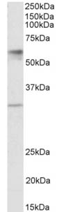 Western blot - Anti-SLC17A5 antibody (AB174759), expandable thumbnail