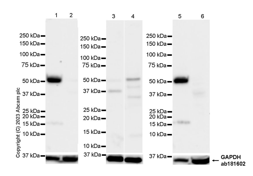 Western blot - Anti-SLC17A5 antibody [EPR27951-4] (AB314223), expandable thumbnail