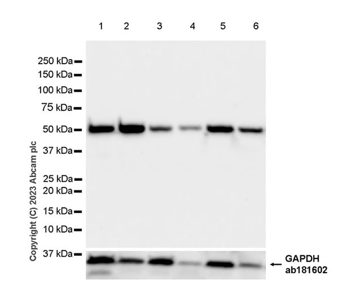 Western blot - Anti-SLC17A5 antibody [EPR27951-4] (AB314223), expandable thumbnail