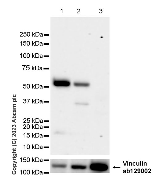 Western blot - Anti-SLC17A5 antibody [EPR27951-4] - BSA and Azide free (AB314224)