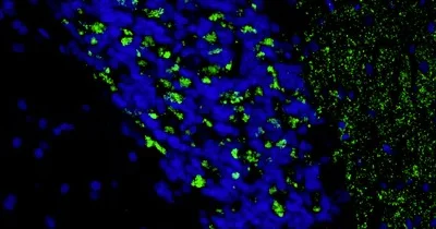 Immunohistochemistry (Formalin/PFA-fixed paraffin-embedded sections) - Anti-Slc17a6 antibody [N29/29] - Chicken IgY (Chimeric) (AB325670)