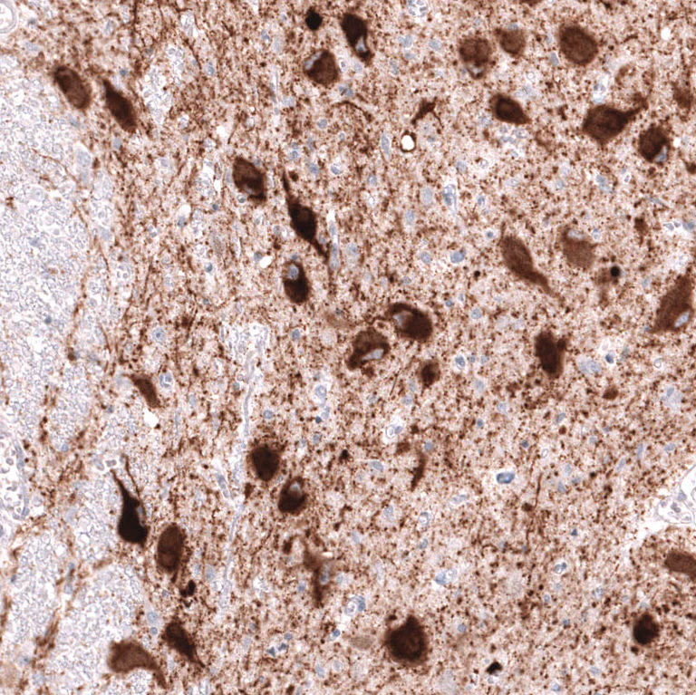 Immunohistochemistry (Formalin/PFA-fixed paraffin-embedded sections) - Anti-SLC18A2 Antibody [CL13157] (AB327144)
