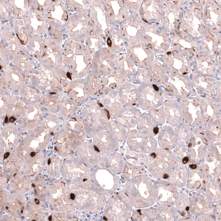 Immunohistochemistry (Formalin/PFA-fixed paraffin-embedded sections) - Anti-SLC18A2 Antibody [CL13157] (AB327144)