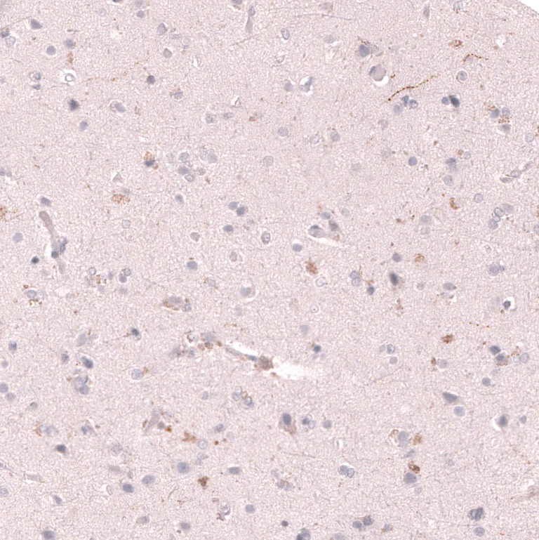 Immunohistochemistry (Formalin/PFA-fixed paraffin-embedded sections) - Anti-SLC18A2 Antibody [CL13157] (AB327144)