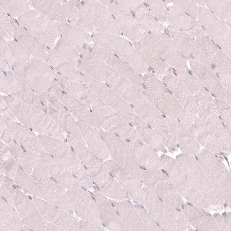 Immunohistochemistry (Formalin/PFA-fixed paraffin-embedded sections) - Anti-SLC18A2 Antibody [CL13157] (AB327144)