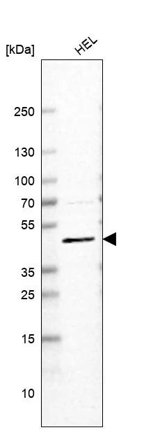 Western blot - Anti-SLC18A2 Antibody [CL13157] (AB327144)