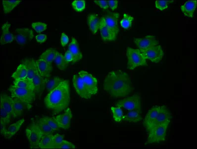 Immunocytochemistry/ Immunofluorescence - Anti-SLC19A3 antibody (AB237630)