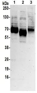 Western blot - Anti-SLC1A5/ASCT2 antibody (AB187692)