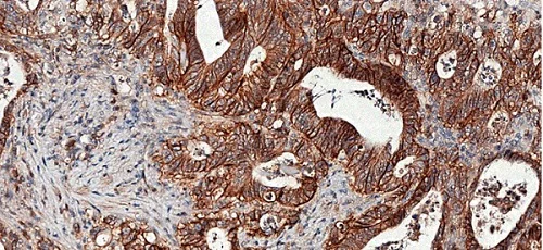 Immunohistochemistry (Formalin/PFA-fixed paraffin-embedded sections) - Anti-SLC1A5/ASCT2 antibody [CAL33] - BSA and Azide free (AB251591)
