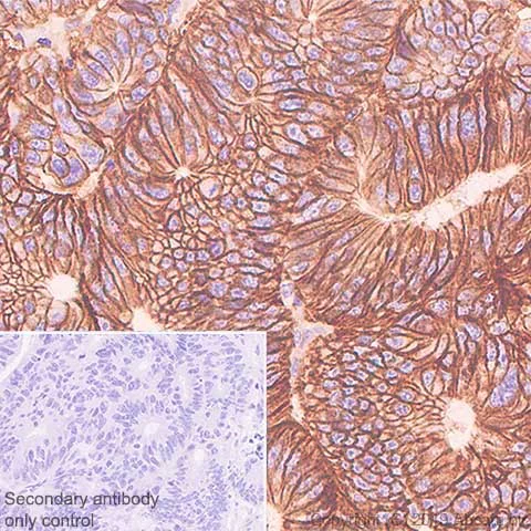 Immunohistochemistry (Formalin/PFA-fixed paraffin-embedded sections) - Anti-SLC1A5/ASCT2 antibody [CAL33] - BSA and Azide free (AB251591)