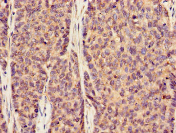 Immunohistochemistry (Formalin/PFA-fixed paraffin-embedded sections) - Anti-SLC20A1 antibody (AB237527)