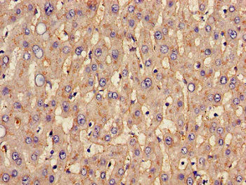 Immunohistochemistry (Formalin/PFA-fixed paraffin-embedded sections) - Anti-SLC20A1 antibody (AB237527)