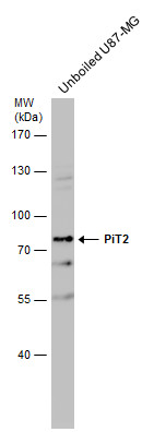 Western blot - Anti-SLC20A2/PIT2 antibody (AB155259), expandable thumbnail