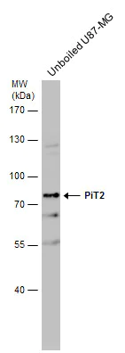 Western blot - Anti-SLC20A2/PIT2 antibody (AB155259)