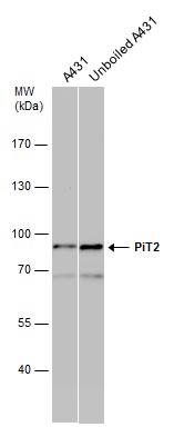 Western blot - Anti-SLC20A2/PIT2 antibody (AB155259), expandable thumbnail