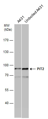 Western blot - Anti-SLC20A2/PIT2 antibody (AB155259)