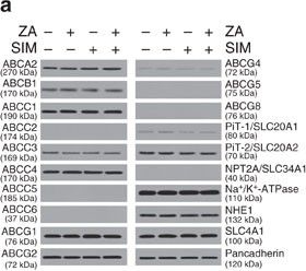 Western blot - Anti-SLC20A2/PIT2 antibody (AB155259), expandable thumbnail