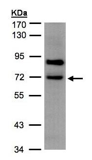 Western blot - Anti-SLC20A2/PIT2 antibody (AB155259), expandable thumbnail
