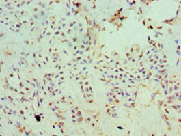 Immunohistochemistry (Formalin/PFA-fixed paraffin-embedded sections) - Anti-SLC20A2/PIT2 antibody (AB238337), expandable thumbnail